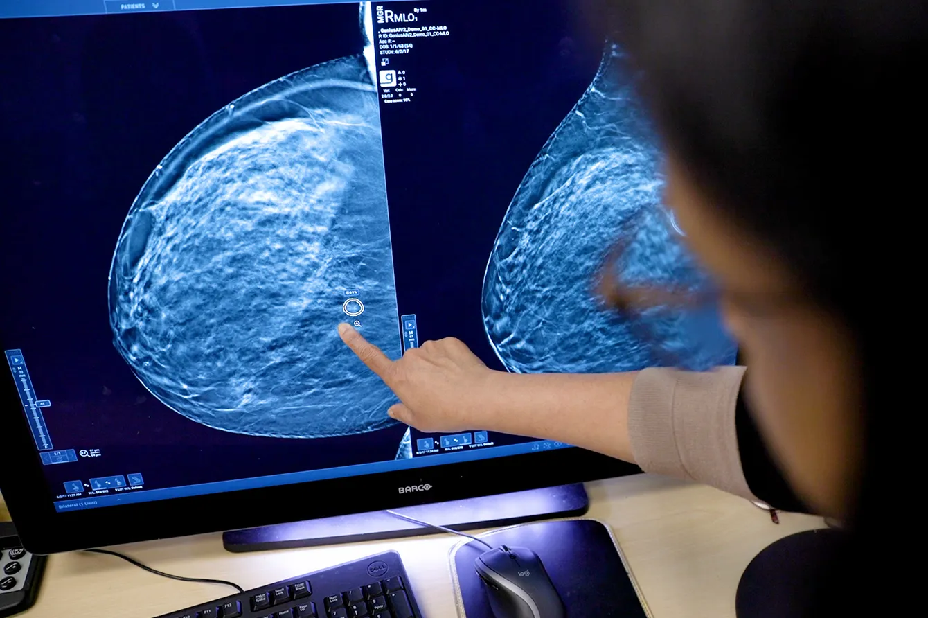 Healthcare technician interacting with monitor showing digital scans