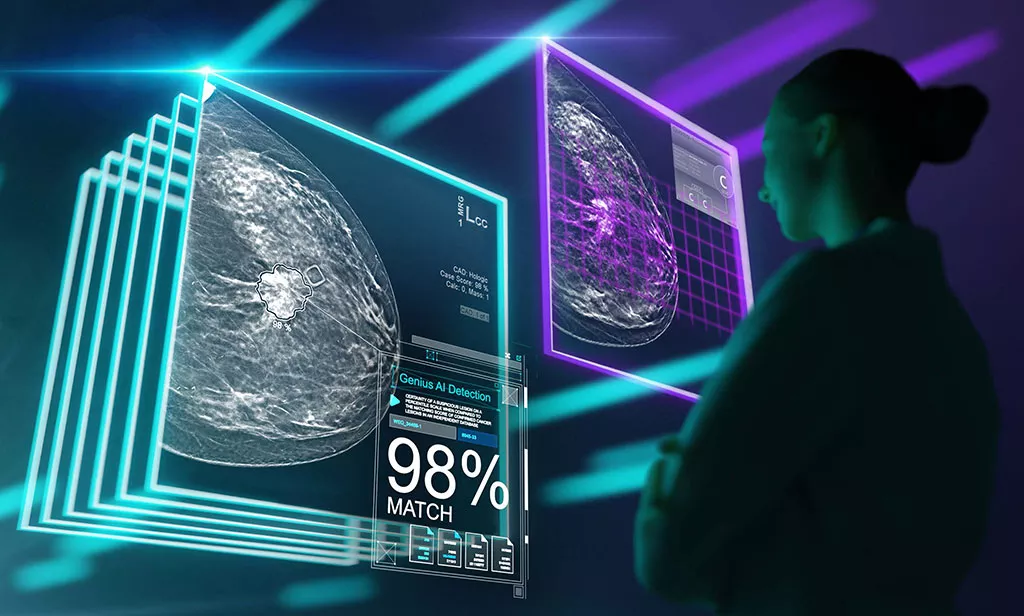 Graphic of x-rays