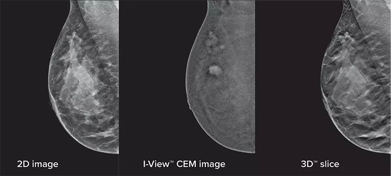 x-ray images