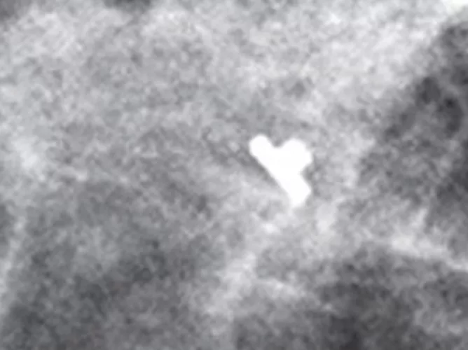 x-ray image